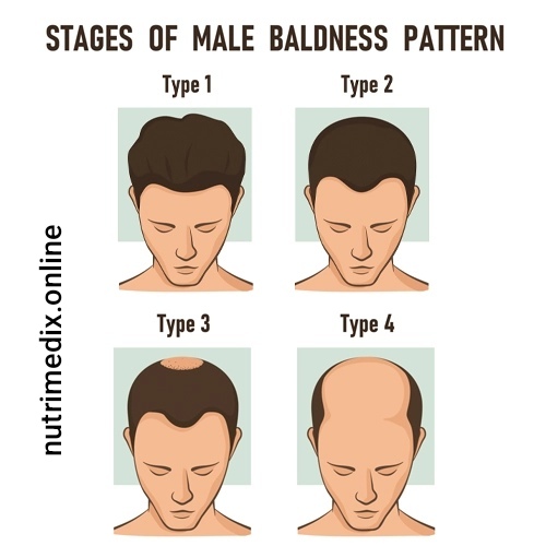 Hair loss